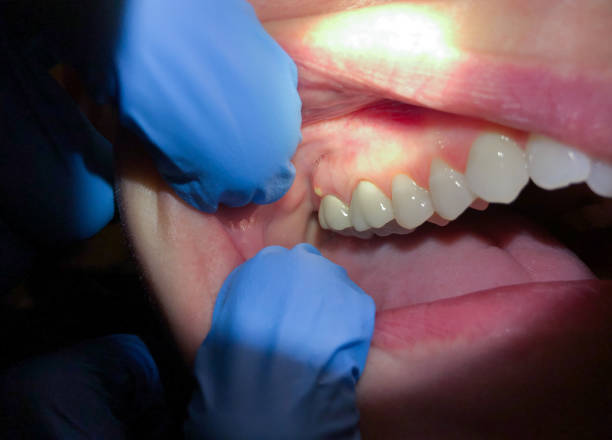 Best Emergency Denture Repair in Little River, SC